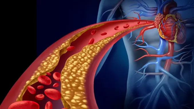 1800ss_thinkstock_rf_heart_disease.webp.webp