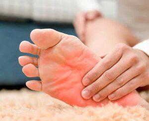 Causes-of-Burning-Feet-300x243