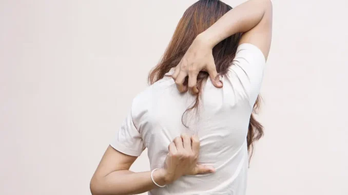 Itchy-back-1
