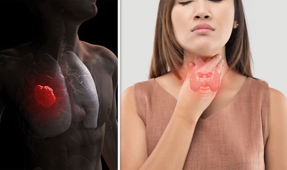 Lung-cancer-symptoms-A-hoarse-voice-not-a-commonly-known-sign-of-the-disease-1388003