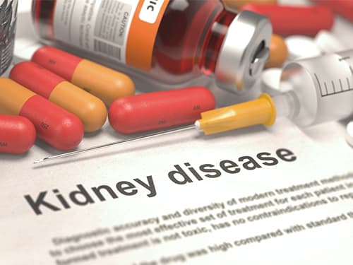 drugabuse-shutter285725171-kidney-disease