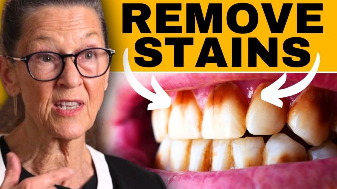 Easy Ways to Remove Deep Brown Tooth Stains Using Common Kitchen Ingredients