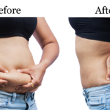 Say Goodbye to Belly Fat: 5 Proven Methods That Actually Work