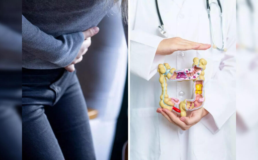 Colon Cancer Warning: 5 Signs You Should Never Ignore—See a Doctor Immediately!