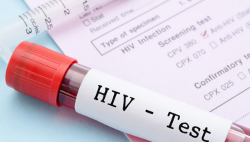 Early Signs That Suggest You Should Get Tested for HIV