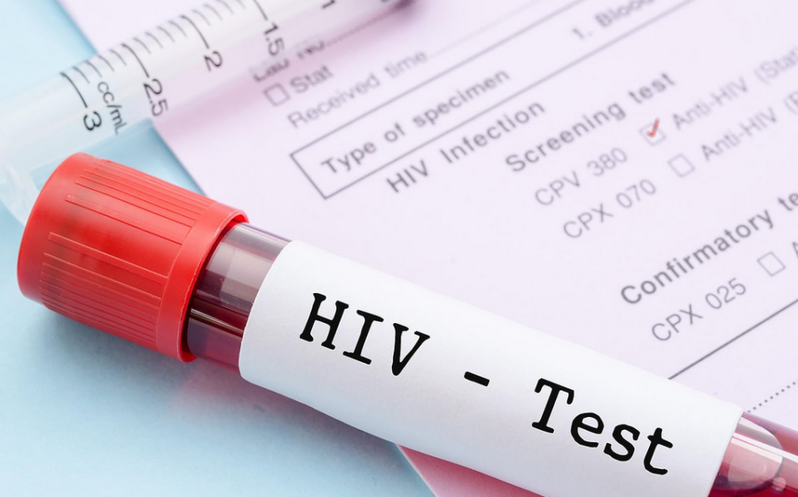 Early Signs That Suggest You Should Get Tested for HIV