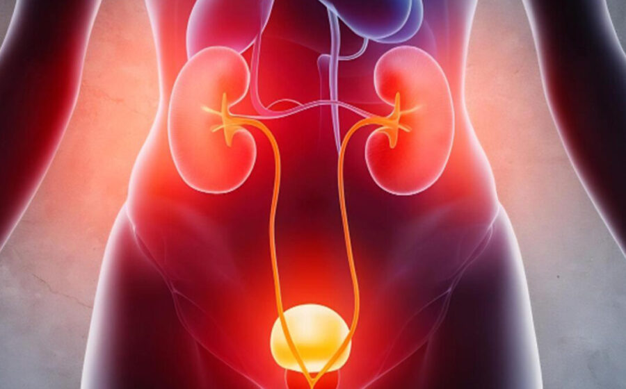 These 3 Common Things May Be Secretly Damaging Your Urinary Tract Every Day
