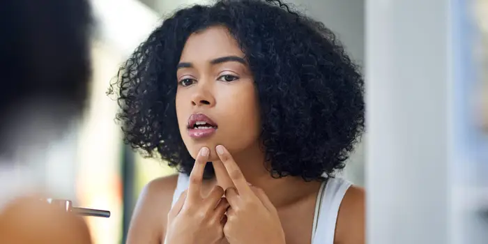 How Vitamin A Can Help Treat Acne